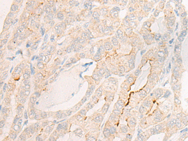 IGSF3 Antibody