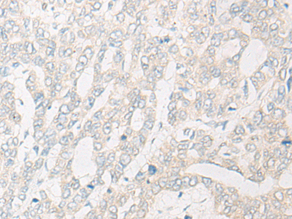 IGSF3 Antibody