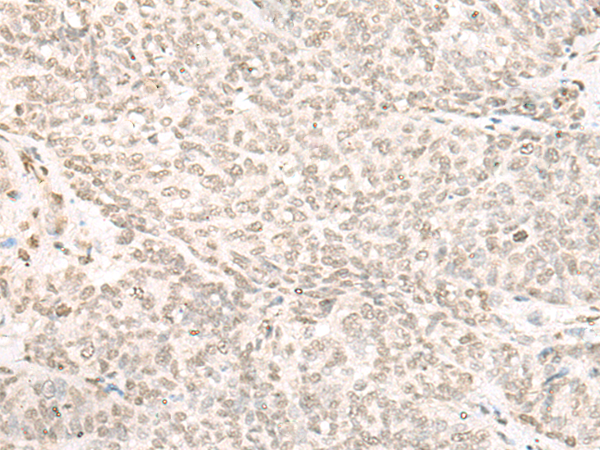 KAT14 Antibody