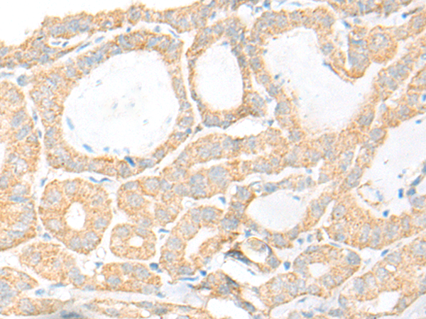 KCNH5 Antibody