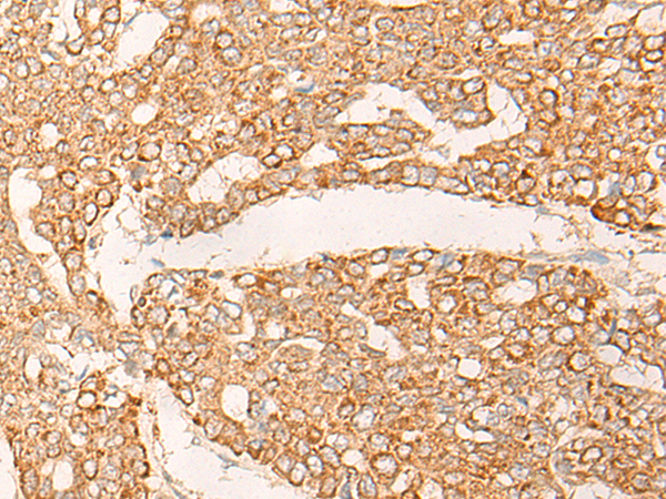 KRT9 Antibody