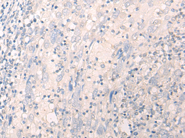 LILRA2 Antibody