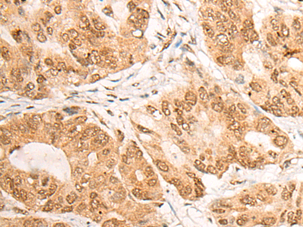 LPIN1 Antibody