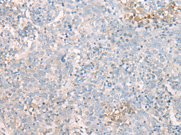 MBOAT7 Antibody