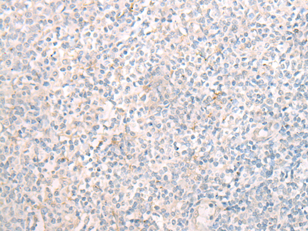 MBOAT7 Antibody