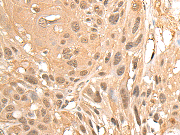 MED23 Antibody