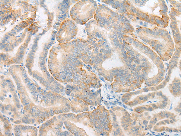 MICU3 Antibody