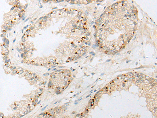 MICU3 Antibody