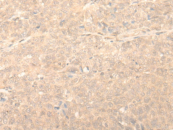 MRI1 Antibody