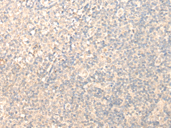 MRPL1 Antibody