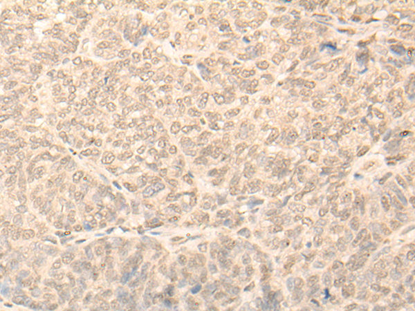 NARF Antibody