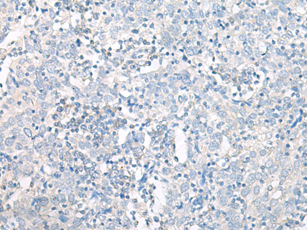 NCLN Antibody