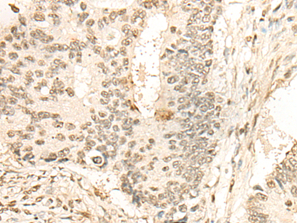 NEIL1 Antibody