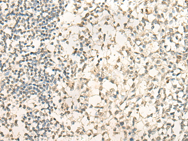 NEIL1 Antibody