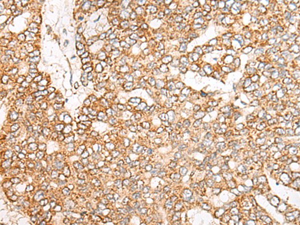 NME4 Antibody