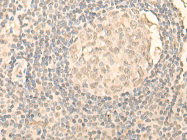 NOLC1 Antibody