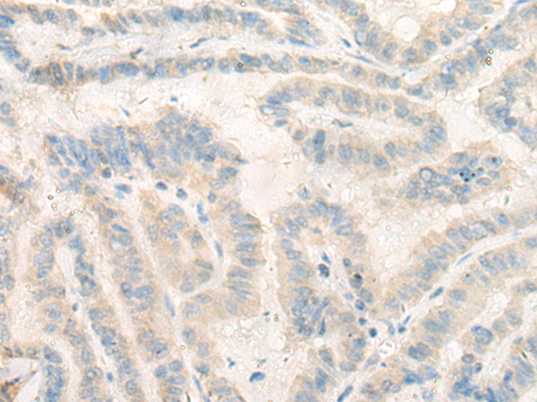 NOSIP Antibody