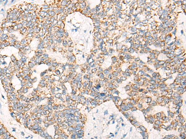 NTRK2 Antibody