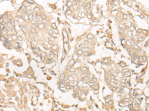 NUBP2 Antibody