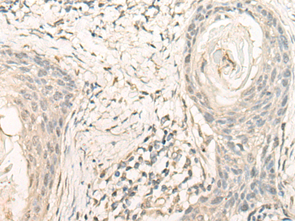 NUBP2 Antibody