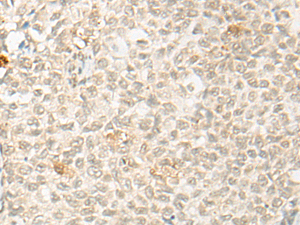 OTX1 Antibody