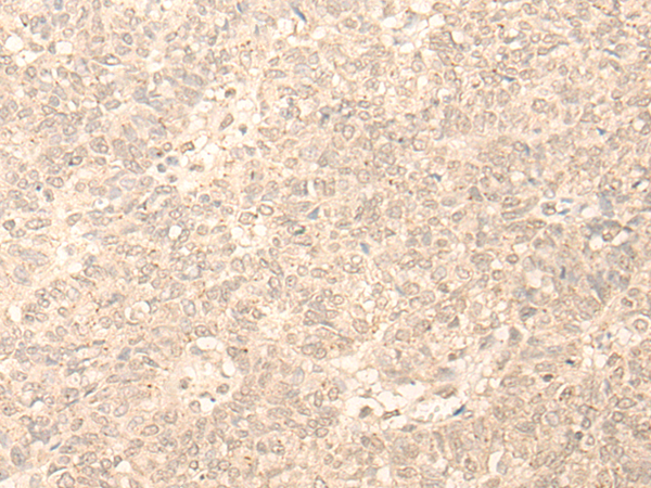 PLEKHA1 Antibody