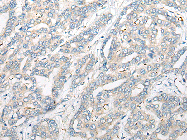 PSEN1 Antibody