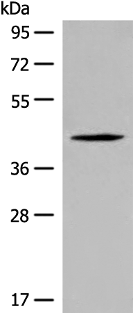 QTRT1 Antibody