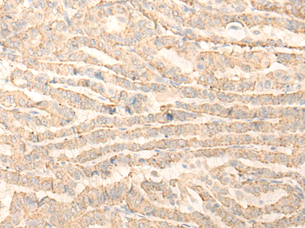 QTRT1 Antibody