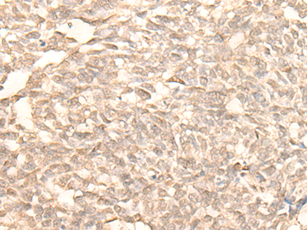 RAD23B Antibody