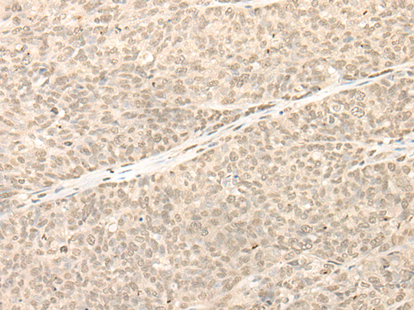 RBM11 Antibody