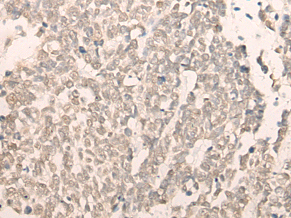 RBM17 Antibody