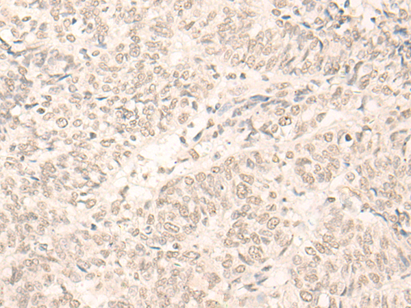 RBM17 Antibody