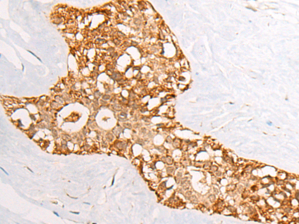 RBMS2 Antibody