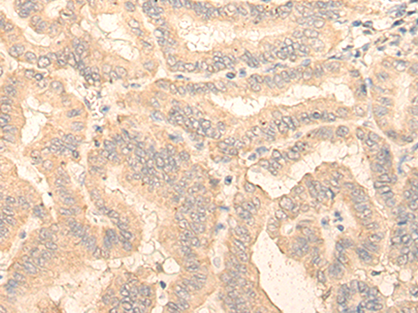 RGP1 Antibody