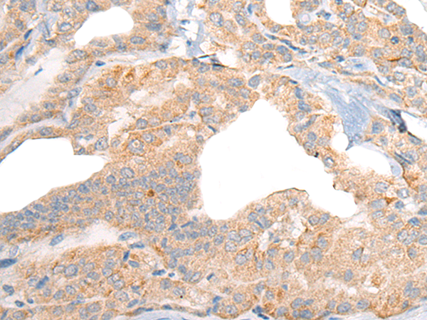 RGS19 Antibody