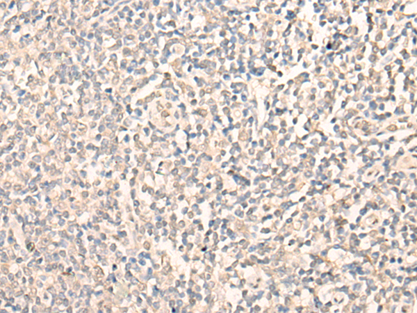 RIOX2 Antibody