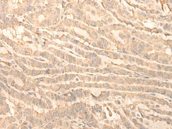 RNF146 Antibody