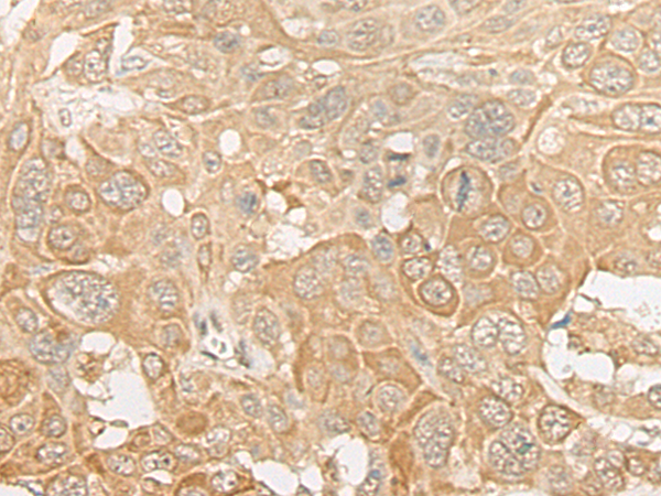 ROM1 Antibody