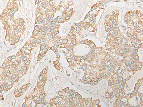 RSPH14 Antibody