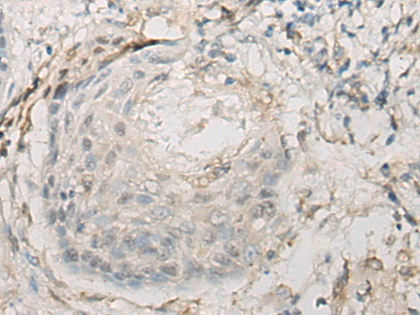 RSPH14 Antibody