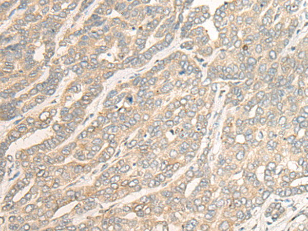 RSU1 Antibody