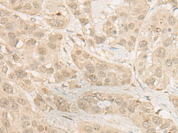 RSU1 Antibody