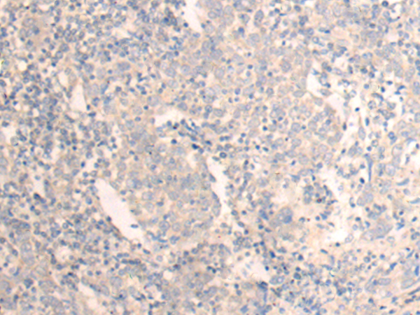 SAMM50 Antibody