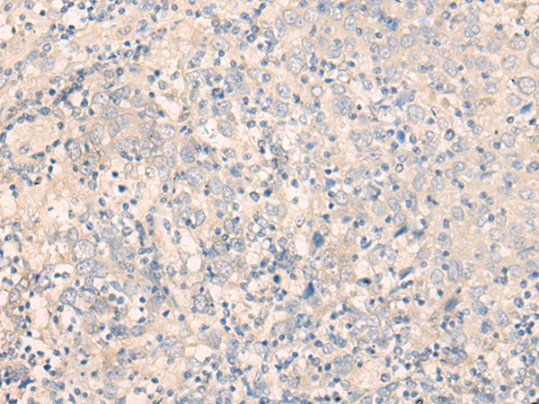 SEPT10 Antibody