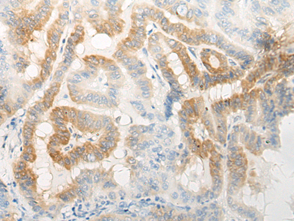 SGCA Antibody