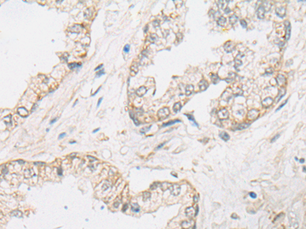 SLC22A24 Antibody