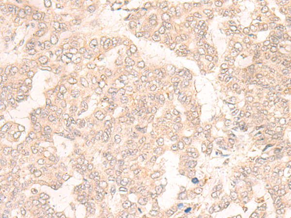 SLC29A2 Antibody