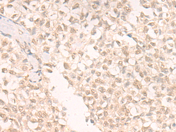 SLC29A2 Antibody