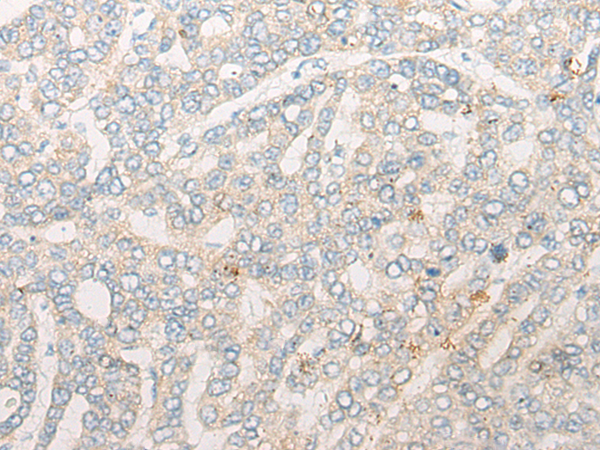 SLC37A4 Antibody